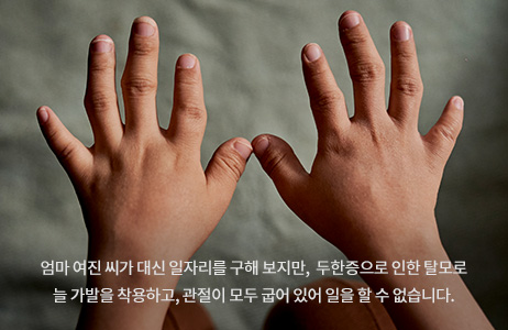 엄마 여진 씨가 대신 일자리를 구해 보지만, 두한증으로 인한 탈모로 늘 가발을 착용하고, 관절이 모두 굽어 있어 일을 할 수 없습니다.